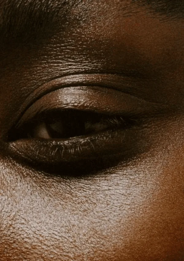 Gros plan sur l’œil et la paupière, blépharoplastie, Dr Cheick Diakité, Abidjan